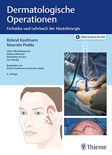 Dermatologische Operationen: Farbatlas und Lehrbuch der Hautchirurgie von Thieme